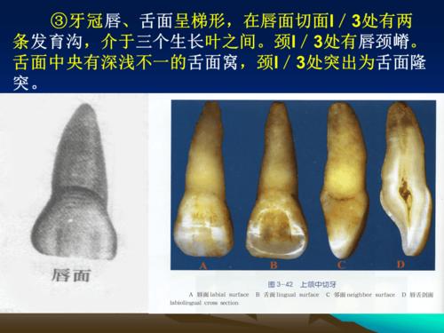 牙的矢状切面