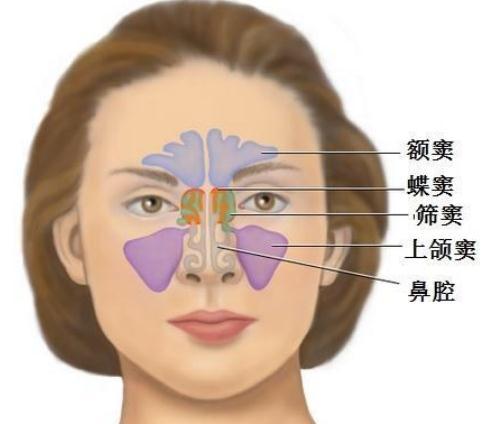 上颌窦窦口开放术头疼