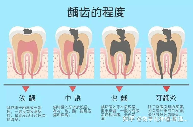 突破龋齿困扰神奇牙龈再生术助您重获完美笑容