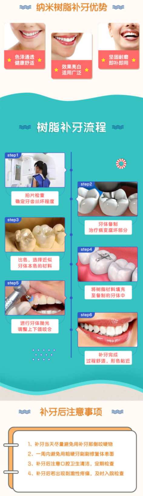 光速修复补牙新材料大揭秘